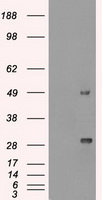 MKI67 / Ki67 Antibody - HEK293T cells were transfected with the pCMV6-ENTRY control (Left lane) or pCMV6-ENTRY MKI67 (Right lane) cDNA for 48 hrs and lysed. Equivalent amounts of cell lysates (5 ug per lane) were separated by SDS-PAGE and immunoblotted with anti-MKI67.