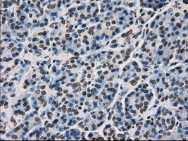 MKI67 / Ki67 Antibody - Immunohistochemical staining of paraffin-embedded pancreas tissue using anti-MKI67 mouse monoclonal antibody. (Dilution 1:50).