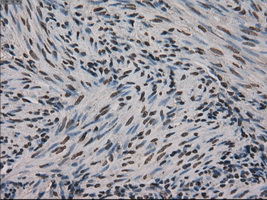 MKI67 / Ki67 Antibody - Immunohistochemical staining of paraffin-embedded endometrium tissue using anti-MKI67 mouse monoclonal antibody. (Dilution 1:50).