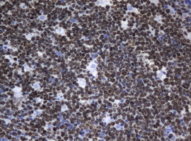 MKI67 / Ki67 Antibody - IHC of paraffin-embedded Human tonsil using anti-${SYMBOL} mouse monoclonal antibody.
