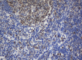 MKI67 / Ki67 Antibody - IHC of paraffin-embedded Human lymph node tissue using anti-MKI67 mouse monoclonal antibody.
