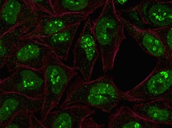 MKI67 / Ki67 Antibody - IF staining of human HeLa cells with Ki67 antibody (green, clone PMKI67-1) and Phalloidin (red, membrane stain).