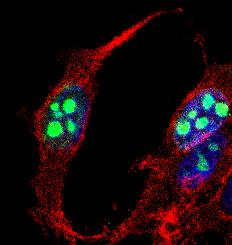 MKI67 / Ki67 Antibody - Immunocytochemistry/Immunofluorescence: Ki67 Antibody - Confocal immunofluorescent analysis of MCF7 cells using Ki67 antibody (1:5). An Alexa Fluor 488-conjugated Goat to rabbit IgG was used as secondary antibody (green). Actin filaments were labeled with Alexa Fluor 568 phalloidin (red). DAPI was used to stain the cell nuclei (blue).  This image was taken for the unconjugated form of this product. Other forms have not been tested.