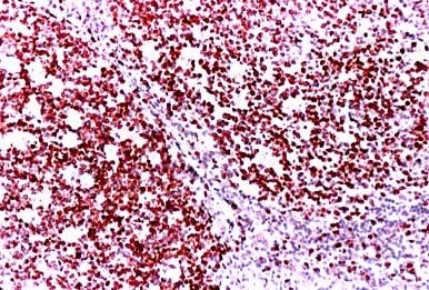 MKI67 / Ki67 Antibody - Immunohistochemistry-Paraffin: Ki67 Antibody - Human tonsil.  This image was taken for the unconjugated form of this product. Other forms have not been tested.