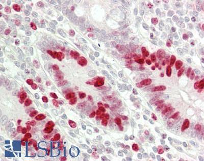 MKI67 / Ki67 Antibody - Human Small Intestine: Formalin-Fixed, Paraffin-Embedded (FFPE).  This image was taken for the unconjugated form of this product. Other forms have not been tested.
