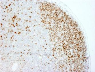 MKI67 / Ki67 Antibody - Ki67 Antibody - FFPE section of mouse Peyer's patch. Antibody: Affinity purified rabbit anti-mouse Ki-67 used at a dilution of 1:250. Detection: DAB staining using Immunohistochemistry Accessory Kit. Epitope Retrieval Buffer-High pH was substituted for Epitope Retrieval Buffer-Reduced pH.  This image was taken for the unconjugated form of this product. Other forms have not been tested.