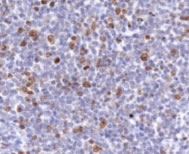 MKI67 / Ki67 Antibody - Ki67 Antibody - IHC of mouse spleen.  This image was taken for the unconjugated form of this product. Other forms have not been tested.