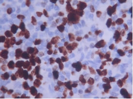 MKI67 / Ki67 Antibody - Ki67 Antibody - Detection of human lymph node. (40X).  This image was taken for the unconjugated form of this product. Other forms have not been tested.