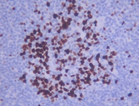 MKI67 / Ki67 Antibody - Ki67 Antibody - Detection of human lymph node. (20X).  This image was taken for the unconjugated form of this product. Other forms have not been tested.