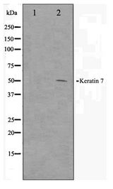 MKI67 / Ki67 Antibody - Western blot of Ki67 antibody