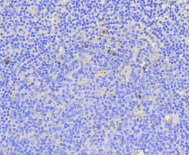 MKI67 / Ki67 Antibody - Immunohistochemistry of paraffin-embedded human tonsil using MKI67 antibodyat dilution of 1:100 (40x lens).