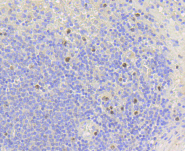 MKI67 / Ki67 Antibody - Immunohistochemistry of paraffin-embedded human spleen using MKI67 antibodyat dilution of 1:100 (40x lens).