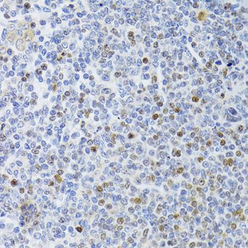 MKI67 / Ki67 Antibody - Immunohistochemistry of paraffin-embedded rat spleen using MKI67 Antibody at dilution of 1:100 (40x lens).
