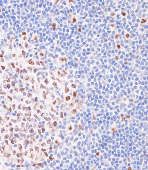 MKI67 / Ki67 Antibody - Immunohistochemical analysis of Ki-67 in Human tonsil tissue sections (IHC-P - paraformaldehyde-fixed, paraffin-embedded sections). Tissue was fixed with formaldehyde at room temperature; antigen retrieval was by heat mediation with a EDTA buffer (pH9.0). Samples were incubated with primary antibody (1/400) for 1 hours at room temperature. A undiluted biotinylated CRF Anti-Polyvalent HRP Polymer antibody was used as the secondary antibody.