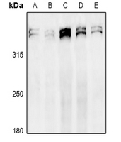 MKI67 / Ki67 Antibody - Western blot analysis of Ki67 expression in HCT116 (A), U87MG (B), HepG2 (C), LO2 (D), SKOVCAR3 (E) whole cell lysates.