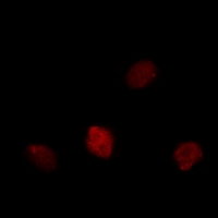 MKI67 / Ki67 Antibody - Immunofluorescent analysis of Ki67 staining in COS7 cells. Formalin-fixed cells were permeabilized with 0.1% Triton X-100 in TBS for 5-10 minutes and blocked with 3% BSA-PBS for 30 minutes at room temperature. Cells were probed with the primary antibody in 3% BSA-PBS and incubated overnight at 4 °C in a hidified chamber. Cells were washed with PBST and incubated with Alexa Fluor 647-conjugated secondary antibody (red) in PBS at room temperature in the dark.