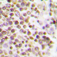 MKI67 / Ki67 Antibody - Immunohistochemical analysis of Ki67 staining in human spleen formalin fixed paraffin embedded tissue section. The section was pre-treated using heat mediated antigen retrieval with sodium citrate buffer (pH 6.0). The section was then incubated with the antibody at room temperature and detected using an HRP conjugated compact polymer system. DAB was used as the chromogen. The section was then counterstained with haematoxylin and mounted with DPX.