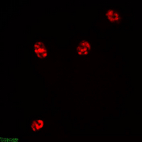 MKI67 / Ki67 Antibody - Immunofluorescent analysis of Ki67 staining in Hela cells. Formalin-fixed cells were permeabilized with 0.1% Triton X-100 in TBS for 5-10 minutes and blocked with 3% BSA-PBS for 30 minutes at room temperature. Cells were probed with the primary antibody in 3% BSA-PBS and incubated overnight at 4 °C in a humidified chamber. Cells were washed with PBST and incubated with a DyLight 594-conjugated secondary antibody (red) in PBS at room temperature in the dark.