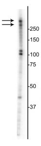 MKI67 / Ki67 Antibody - Western blot of serum starved then re-fed for 2.5 hr T47D cell lysate showing specific immunolabeling of the ~345/395 Ki-67 isoforms. Click here to view our Western blotting and lysate preparation protocols.