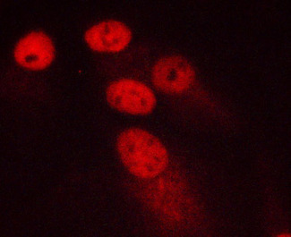 MKI67 / Ki67 Antibody - Staining MCF-7 cells by IF/ICC. The samples were fixed with PFA and permeabilized in 0.1% saponin prior to blocking in 10% serum for 45 min at 37°C. The primary antibody was diluted 1/400 and incubated with the sample for 1 hour at 37°C. A Alexa Fluor® 594 conjugated goat polyclonal to rabbit IgG (H+L), diluted 1/600 was used as secondary antibody.