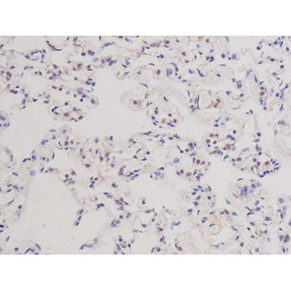 MKI67 / Ki67 Antibody - 1:200 staining rat lung tissue by IHC-P. The tissue was formaldehyde fixed and a heat mediated antigen retrieval step in citrate buffer was performed. The tissue was then blocked and incubated with the antibody for 1.5 hours at 22°C. An HRP conjugated goat anti-rabbit antibody was used as the secondary.