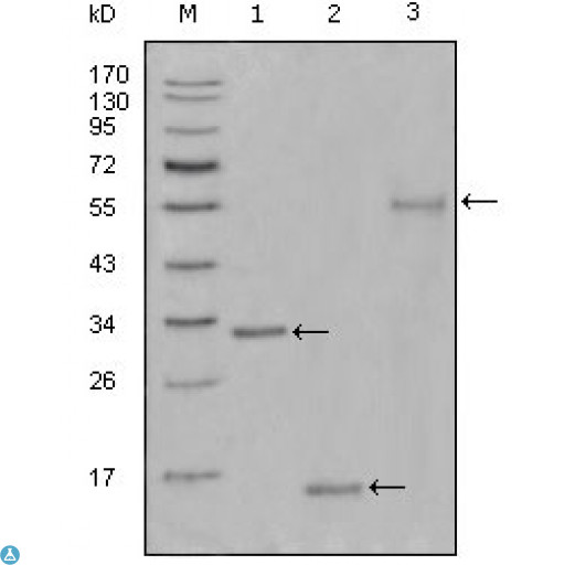 MKI67 / Ki67 Antibody - Western Blot (WB) analysis using Ki-67 Monoclonal Antibody against truncated Trx-Ki67 recombinant protein(1),truncated Ki67 (aa3118-3256)-His recombinant protein(2) and truncated Ki67 (aa3118-3256)-hIgGFc transfected CHO-K1 cell lysate(3).