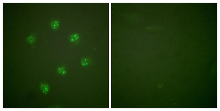 MKI67 / Ki67 Antibody - Peptide - + Immunofluorescence analysis of COS7 cells, using Ki67antibody.