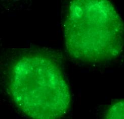 MKI67 / Ki67 Antibody - Immunofluorescent analysis of (4% PFA) fixed HeLa cells using KI67 antibody at dilution of 1:50 and Alexa Fluor 488-congugated Goat Anti-Rabbit IgG(H+L)