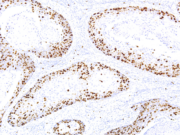 MKI67 / Ki67 Antibody