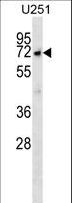 MKKS Antibody - MKKS Antibody western blot of U251 cell line lysates (35 ug/lane). The MKKS antibody detected the MKKS protein (arrow).