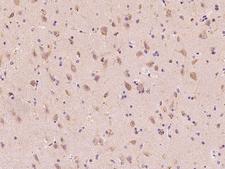 MKKS Antibody - Immunochemical staining of human MKKS in human brain with rabbit polyclonal antibody at 1:300 dilution, formalin-fixed paraffin embedded sections.