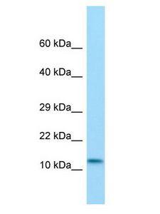 MKL2 Antibody - MKL2 antibody Western Blot of Rat Pancreas. Antibody dilution: 1 ug/ml.  This image was taken for the unconjugated form of this product. Other forms have not been tested.