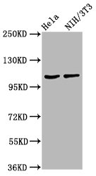 MKL2 Antibody - Western Blot Positive WB detected in: Hela whole cell lysate, NIH/3T3 whole cell lysate All Lanes: MKL2 antibody at 4.2µg/ml Secondary Goat polyclonal to rabbit IgG at 1/50000 dilution Predicted band size: 119, 43, 52, 115, 120 KDa Observed band size: 119 KDa