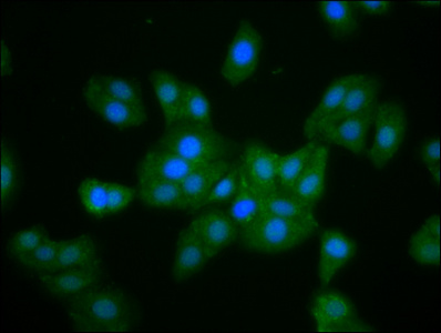 MKLN1 / Muskelin Antibody - Immunofluorescence staining of HepG2 cells diluted at 1:133, counter-stained with DAPI. The cells were fixed in 4% formaldehyde, permeabilized using 0.2% Triton X-100 and blocked in 10% normal Goat Serum. The cells were then incubated with the antibody overnight at 4°C.The Secondary antibody was Alexa Fluor 488-congugated AffiniPure Goat Anti-Rabbit IgG (H+L).