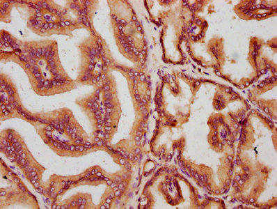 MKLN1 / Muskelin Antibody - Immunohistochemistry Dilution at 1:400 and staining in paraffin-embedded human prostate tissue performed on a Leica BondTM system. After dewaxing and hydration, antigen retrieval was mediated by high pressure in a citrate buffer (pH 6.0). Section was blocked with 10% normal Goat serum 30min at RT. Then primary antibody (1% BSA) was incubated at 4°C overnight. The primary is detected by a biotinylated Secondary antibody and visualized using an HRP conjugated SP system.