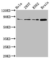 MKLN1 / Muskelin Antibody - Western Blot Positive WB detected in: Hela whole cell lysate, 293T whole cell lysate, K562 whole cell lysate, Rat brain tissue All Lanes: MKLN1 antibody at 2.7µg/ml Secondary Goat polyclonal to rabbit IgG at 1/50000 dilution Predicted band size: 85, 61 KDa Observed band size: 85 KDa