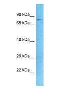 MKLN1 / Muskelin Antibody - Western blot of MKLN1 Antibody with human 293T Whole Cell lysate.  This image was taken for the unconjugated form of this product. Other forms have not been tested.