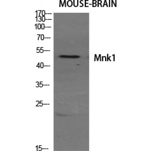 MKNK1 / MNK1 Antibody - Western blot of Mnk1 antibody