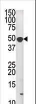 MKNK1 / MNK1 Antibody - The anti-MKNK1 antibody is used in Western blot to detect MKNK1 in A2058 tissue lysate