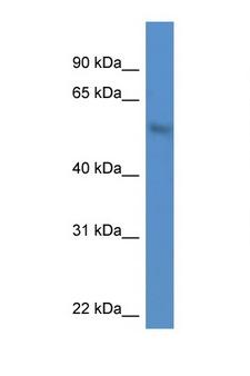 MKNK1 / MNK1 Antibody - MKNK1 / MNK1 antibody Western blot of A549 Cell lysate. Antibody concentration 1 ug/ml.  This image was taken for the unconjugated form of this product. Other forms have not been tested.