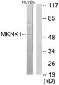 MKNK1 / MNK1 Antibody - Western blot analysis of lysates from HUVEC cells, using MKNK1 Antibody. The lane on the right is blocked with the synthesized peptide.