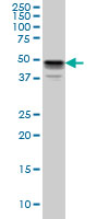 MKNK1 / MNK1 Antibody - MKNK1 monoclonal antibody (M06), clone 3E1 Western blot of MKNK1 expression in HeLa.