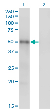 MKNK1 / MNK1 Antibody - Western blot of MKNK1 expression in transfected 293T cell line by MKNK1 monoclonal antibody (M06), clone 3E1.