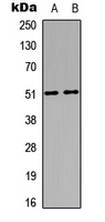 MKNK1 / MNK1 Antibody - Western blot analysis of MNK1 expression in MCF7 (A); mouse brain (B) whole cell lysates.
