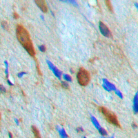 MKNK1 / MNK1 Antibody - Immunohistochemical analysis of MNK1 staining in human brain formalin fixed paraffin embedded tissue section. The section was pre-treated using heat mediated antigen retrieval with sodium citrate buffer (pH 6.0). The section was then incubated with the antibody at room temperature and detected using an HRP conjugated compact polymer system. DAB was used as the chromogen. The section was then counterstained with hematoxylin and mounted with DPX.