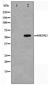 MKNK1 / MNK1 Antibody - Western blot of HeLa cell lysate using MKNK1 Antibody