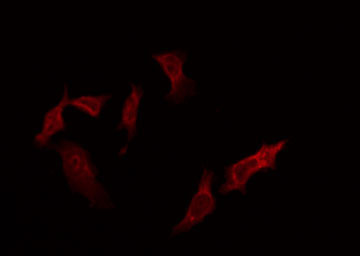 MKNK1 / MNK1 Antibody - Staining HeLa cells by IF/ICC. The samples were fixed with PFA and permeabilized in 0.1% Triton X-100, then blocked in 10% serum for 45 min at 25°C. The primary antibody was diluted at 1:200 and incubated with the sample for 1 hour at 37°C. An Alexa Fluor 594 conjugated goat anti-rabbit IgG (H+L) Ab, diluted at 1/600, was used as the secondary antibody.
