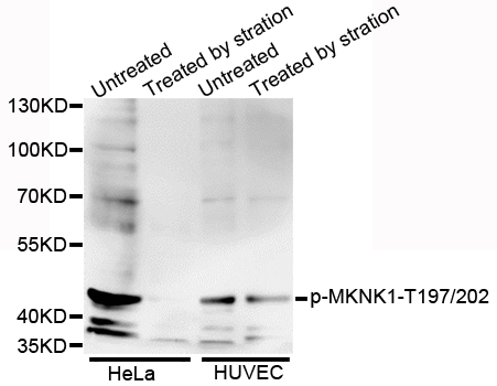 MKNK1 / MNK1 Antibody - Western blot analysis of extracts of various cell lines.