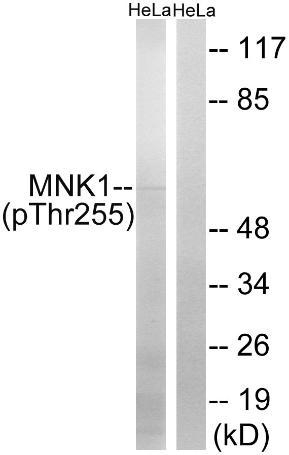MKNK1 / MNK1 Antibody - Western blot analysis of lysates from HeLa cells treated with Adriamycin 0.5ug/ml 24h, using MNK1 (Phospho-Thr255) Antibody. The lane on the right is blocked with the phospho peptide.