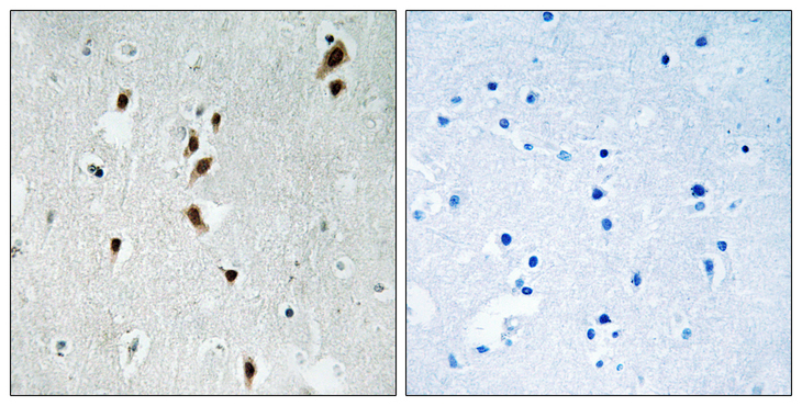 MKNK1 / MNK1 Antibody - Immunohistochemistry analysis of paraffin-embedded human brain, using Mnk1 (Phospho-Thr385) Antibody. The picture on the right is blocked with the phospho peptide.